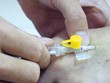 Bảo hiểm y tế đảm bảo chăm sóc cho người nhiễm HIV/AIDS