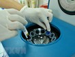 Báo động tình trạng người Việt Nam thừa cholesterol ở mức cao
