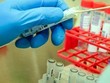 JCVI: Nên tiếp tục triển khai tiêm vaccine COVID-19 theo độ tuổi