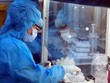 Việt Nam vừa nghiên cứu tự chế tạo, vừa phối hợp mua vaccine COVID-19 từ nước ngoài. Ảnh: Bộ Y tế.