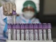 WHO phân loại biến thể ở Ấn Độ là mối đe dọa sức khỏe toàn cầu