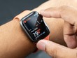 Apple Watch có thể mất tính năng phát hiện nhịp tim do kiện bản quyền?
