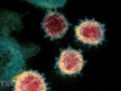 Virus SARS-CoV-2 gây bệnh COVID-19 soi trên kính hiển vi. (Ảnh: AFP/ TTXVN).