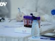 Hà Nội có thêm 3 ca dương tính SARS-CoV-2 từ ổ dịch BV Bệnh Nhiệt đới TW