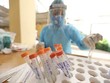 Nhân viên y tế làm công tác xét nghiệm. (Ảnh: TTXVN/Vietnam+).