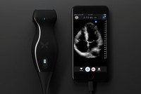 Biến smartphone thành máy siêu âm cầm tay bằng thiết bị Butterfly iQ