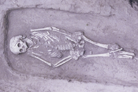 Bộ hài cốt của người thanh niên mắc hội chứng "lùn cân đối". Ảnh: Live Science. 