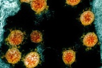 Ảnh minh họa: NewsBox9.