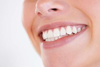 8 điểm cần lưu ý trước khi làm trắng răng