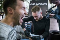 Một người đàn ông đang nhịn đau để cấy chip dưới da tay. Ảnh: AFP.