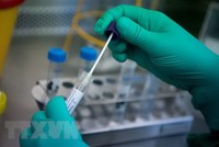 Nghiên cứu viên làm việc trên mẫu bệnh phẩm chứa virus corona chủng mới 2019-nCoV tại phòng thí nghiệm ở Stuttgart, miền Nam Đức ngày 29/1/2020. (Ảnh: AFP/TTXVN)