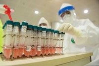 Mẫu xét nghiệm tại Bệnh viện Nhiệt đới Trung ương cơ sở 2.