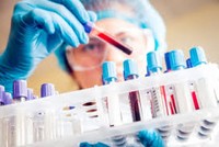 Xét nghiệm nhanh Covid-19. (Ảnh: AP).