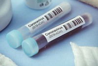 Lọ đựng mẫu xét nghiệm Covid-19. Ảnh: News expat.