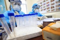 Lấy mẫu xét nghiệm ca bệnh COVID-19. (Ảnh: Thành Đạt/TTXVN).