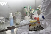 Cán bộ CDC Yên Bái làm xét nghiệm.