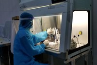 Quy trình xét nghiệm virus SARS-CoV-2.