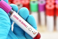 Cộng hòa Séc và Slovakia thắt chặt các quy định nhập cảnh đối với công dân chưa được tiêm chủng đầy đủ đến từ các quốc gia có nguy cơ lây nhiễm cao (Ảnh minh họa, nguồn expats.cz).