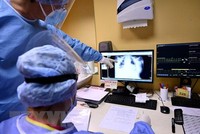 Nhân viên y tế theo dõi hình chụp X-quang phổi của bệnh nhân COVID-19 tại Rome, Italy. (Ảnh: AFP/TTXVN)