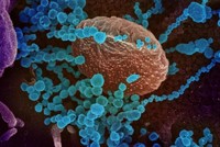 Nguy cơ phát tán virus từ những người đã tiêm chủng và rủi ro tiềm tàng từ biến thể Lambda