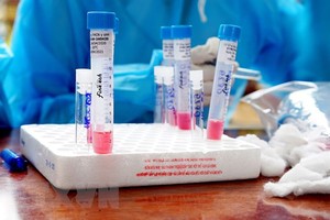 Bệnh nhân 426 tử vong vì bệnh COVID-19 và suy thận giai đoạn cuối