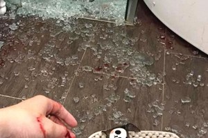 Chủ nhân căn hộ bị thương do kính cường lực trong nhà tắm nổ. Ảnh: Nguyễn Thành