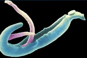 Hình ảnh con sán máng. Ảnh: Infonet.