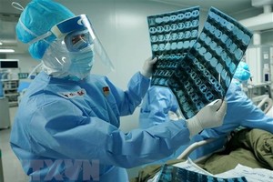Bác sỹ kiểm tra hình chụp CT phổi của bệnh nhân nhiễm COVID-19 tại bệnh viện dã chiến ở Vũ Hán, tỉnh Hồ Bắc, Trung Quốc, ngày 17/3/2020. (Ảnh: THX/TTXVN).