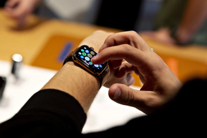 Đồng hồ thông minh Apple Watch. (Nguồn: Getty Images).