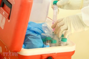 Các mẫu bệnh phẩm chuyển đến các đơn vị xét nghiệm bằng phương pháp RT-PCR. (Ảnh: Minh Quyết/TTXVN).