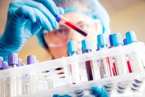 Xét nghiệm nhanh Covid-19. (Ảnh: AP).