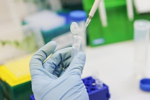 Ảnh minh họa: Quỹ đầu tư trực tiếp Nga.