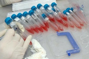 Bệnh viện Phổi Trung ương đã có văn bản gửi Sở Y tế Hưng Yên về trường hợp trên.