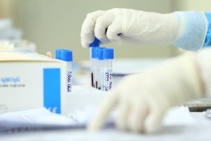 Ảnh minh họa. (Nguồn: TTXVN).