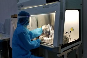 Quy trình xét nghiệm virus SARS-CoV-2.