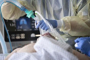 Nhân viên y tế điều trị cho bệnh nhân COVID-19. (Ảnh: AFP/TTXVN)