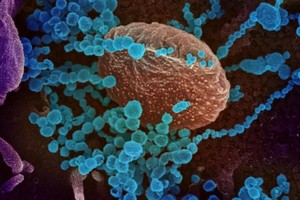 Delta là biến thể Covid-19 nhanh nhất, khỏe nhất và sẽ ảnh hưởng những người dễ bị tổn thương nhất