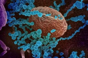 Nguy cơ phát tán virus từ những người đã tiêm chủng và rủi ro tiềm tàng từ biến thể Lambda