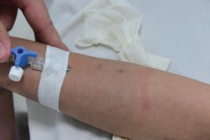 Bảo hiểm sức khỏe tuy bán tốt, nhưng nằm trong nhóm sản phẩm có tỷ lệ trục lợi cao nhất