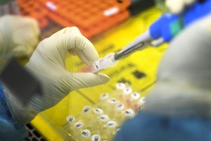 Bộ Y tế ban hành hướng dẫn chẩn đoán, điều trị COVID -19 do SARS-CoV-2