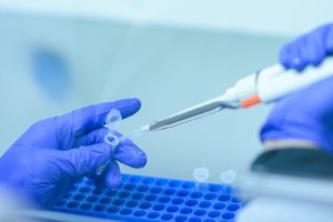 WHO: Những người trẻ tuổi khỏe mạnh có thể không được tiêm ngừa Covid-19 cho đến năm 2022