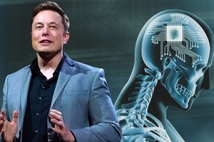 Vừa công bố thành tựu cấy chip lên não người, Elon Musk lập tức lấy lại vị trí giàu nhất thế giới