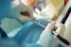 Một mẫu máu xét nghiệm của người dân tại xã Sơn Lôi, huyện Bình Xuyên, tỉnh Vĩnh Phúc. (Ảnh: Hoàng Hùng/TTXVN).