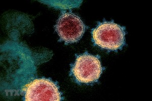 Virus SARS-CoV-2 gây bệnh COVID-19 soi trên kính hiển vi. (Ảnh: AFP/ TTXVN).