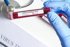 Trường hợp nhập cảnh trái phép ở Vũng Liêm (Vĩnh Long) âm tính lần 1