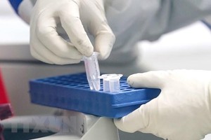 (Ảnh: TTXVN/Vietnam+).