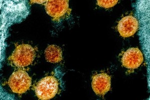 Ảnh minh họa: NewsBox9.