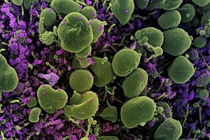 Ảnh minh họa. (Nguồn: AFP/TTXVN).