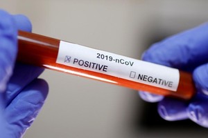 Hà Nội phát hiện thêm 1 ca mắc COVID-19 là cán bộ tư pháp xã Tô Hiệu, Thường Tín