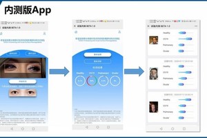 Trung Quốc phát triển công nghệ phát hiện nguy cơ mắc Covid-19 qua kiểm tra mắt (Ảnh: The Paper).